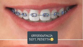 dentista pediatrico firenze DentaliaFirenze :clinica dentale dentista per adulti e bambini 牙科诊所