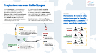 Trapianti di rene incrociati tra Padova, Barcellona e Bilbao