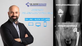 chirurgo della mano padova Dr Ranaldo Ortopedico